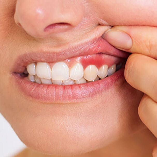 Periodontics
