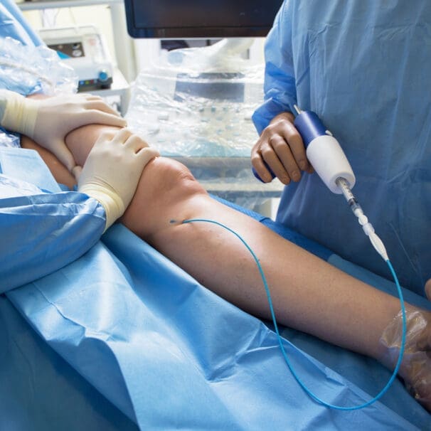 Vascular Surgeons